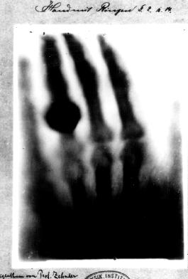 My hand after writing an essay x-ray glasses in other words, they are