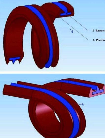 Pedicle screw fixation thesis proposal 140 in the thoracic