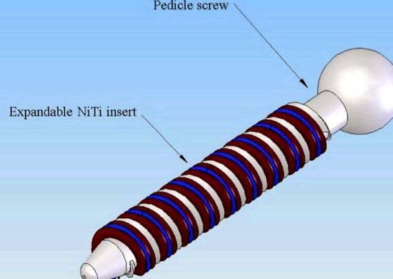 Pedicle screw fixation thesis proposal Studies and Surgery