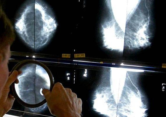 Writing newsletter articles guidelines for mammograms we are not